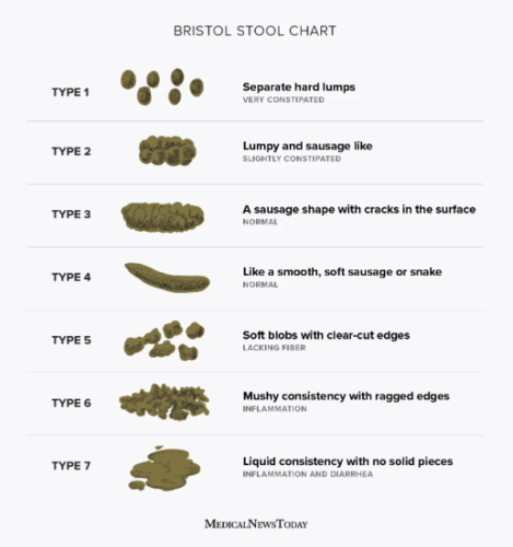 Your poop shape analysis